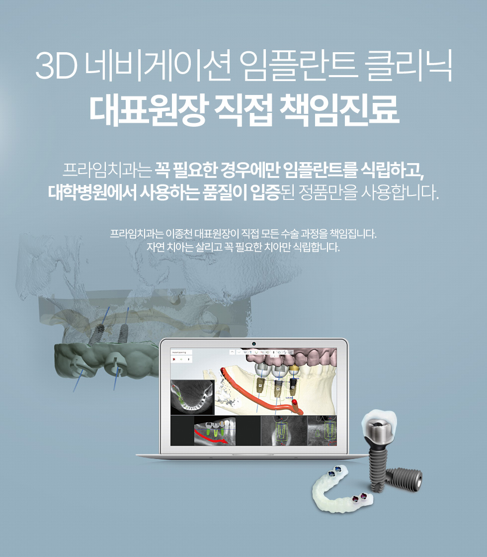 3D 네비게이션 임플란트 클리닉 대표원장 직접 책임진료